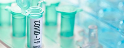 Call di Regione Lombardia per laboratori che ricerchino nei tamponi rinofaringei RNA virale COVID-19