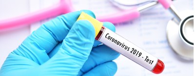 Ministero della Salute: circolare sull'utilizzo di test per COVID-19