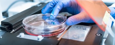 Nuovo bando JPIAMR per la lotta all'antimicrobico-resistenza